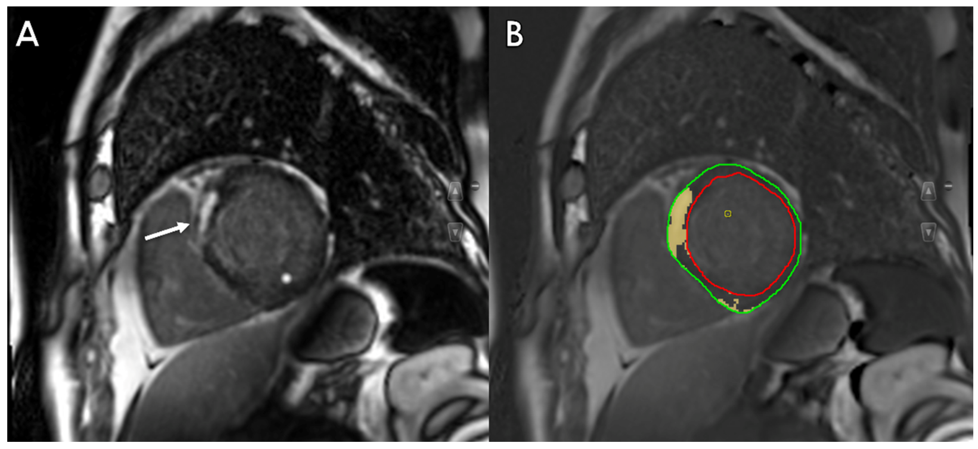 Enhancing Cardiac Imaging with Machine Learning